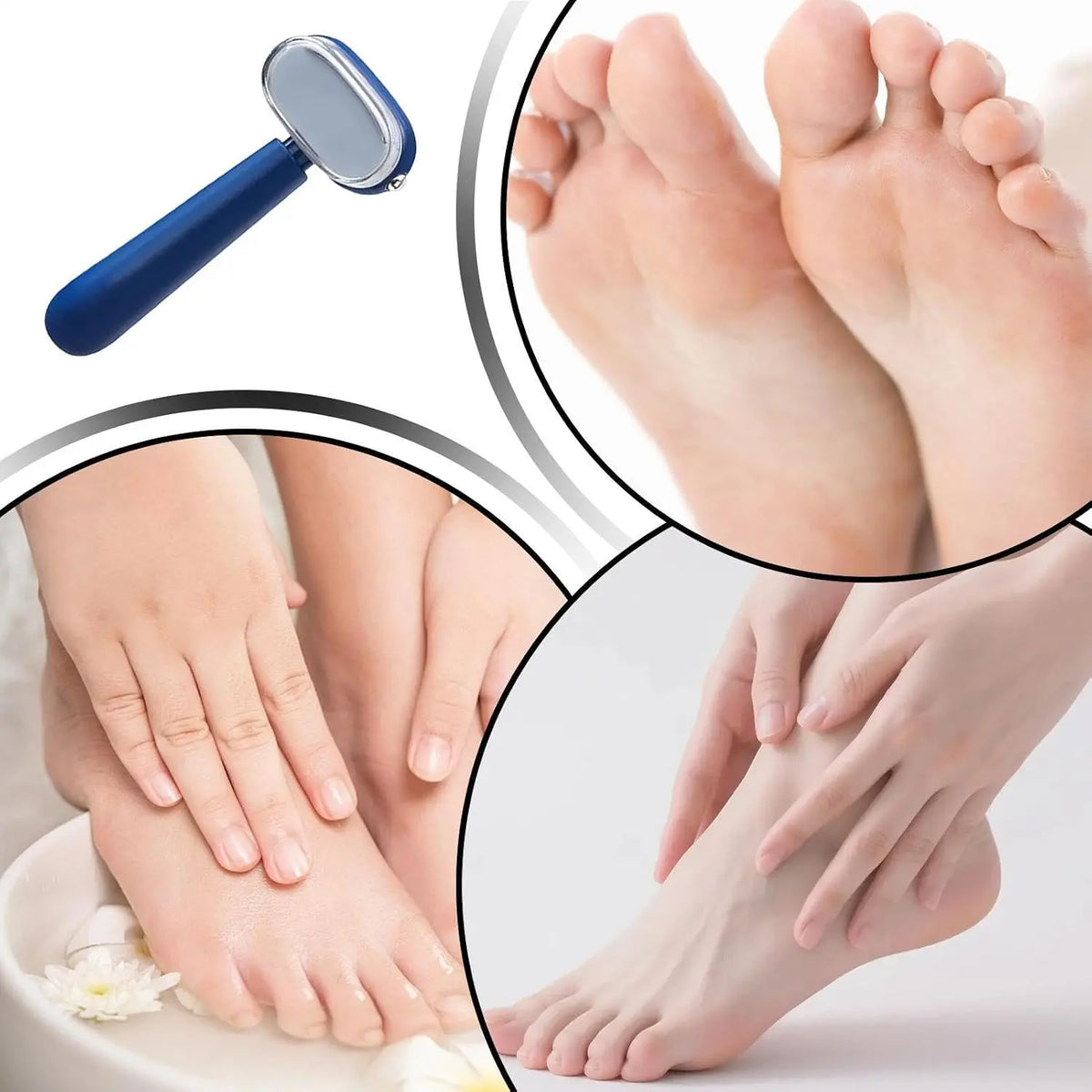 Dual-Sided Callus Remover Tool