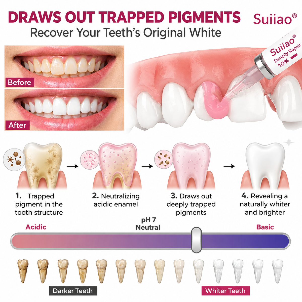 Suiiao® DenPerm Cavity-Repair Natural Enamel Filling Gel