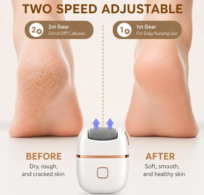 Rechargeable Dual Speed Electric Foot Callus Remover