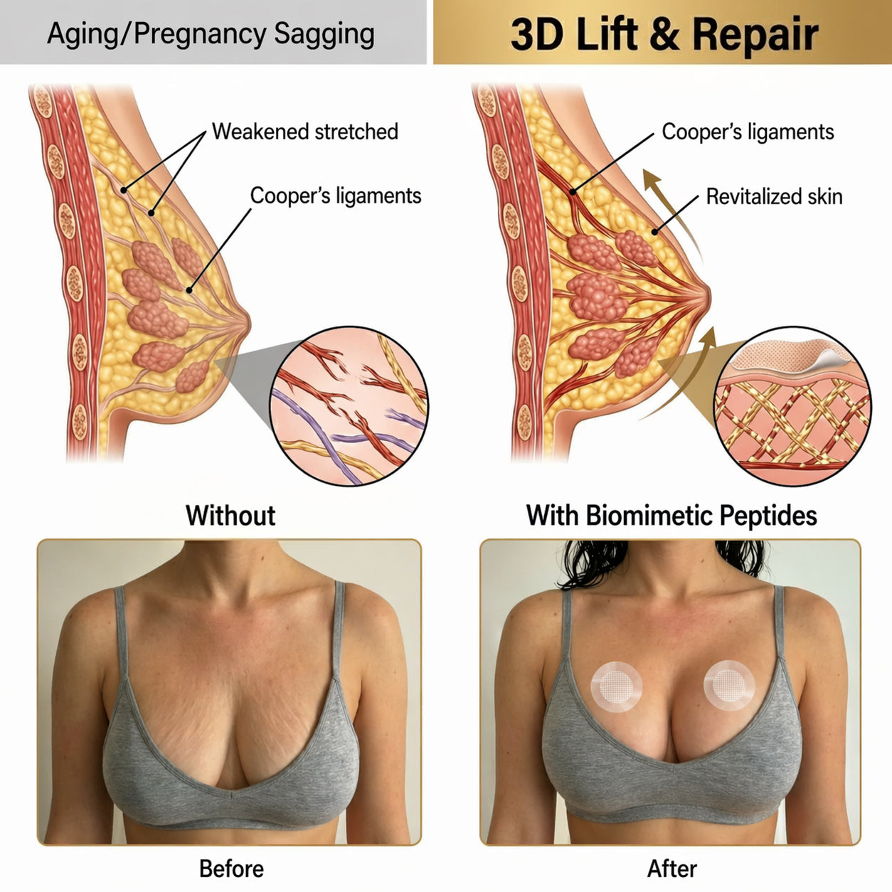 💥pyrolite® 💥Breast Enhancement Patches